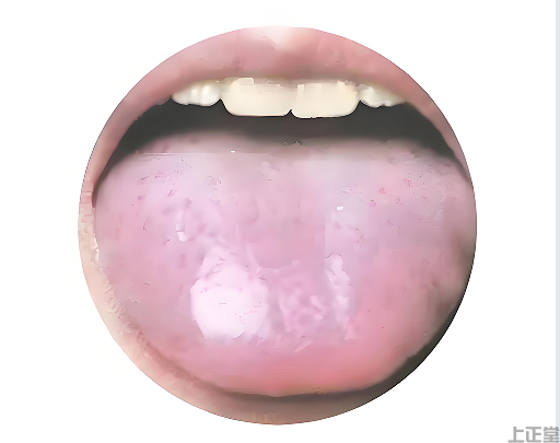 舌苔白厚膩 脾胃濕寒信號燈